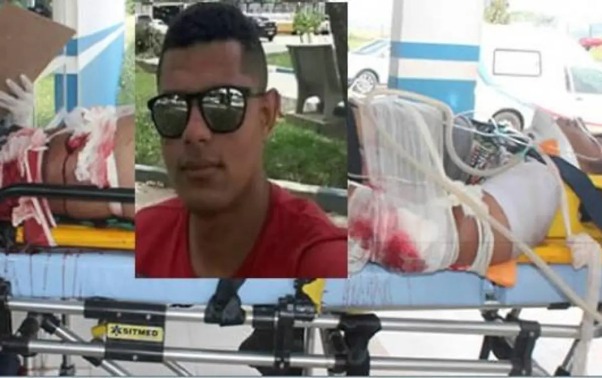 Jovem Que Teve Perna Amputada Em Grave Acidente Morre No Hospital