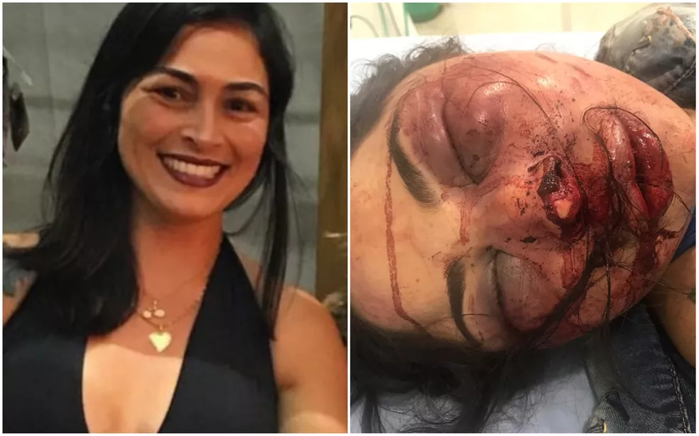 Imagem mostra antes e depois de vítima ser espancada no Espírito Santo — Foto: Divulgação/Rede Social e Polícia Militar Imagem mostra antes e depois de vítima ser espancada no Espírito Santo — Foto: Divulgação/Rede Social e Polícia Militar