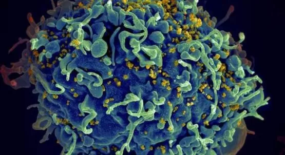 Homem de 66 anos é o quarto paciente curado do HIV no mundo