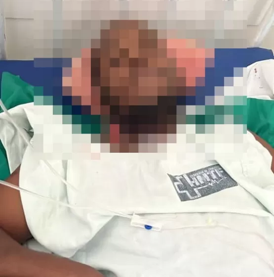 Homem sofre tentativa de homicídio em Posto da Mata