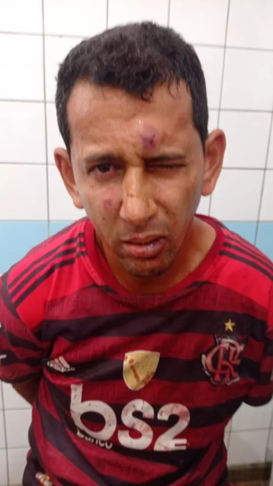 Cinco pessoas são baleadas por causa de discussão envolvendo política em Itamaraju. Autor foi preso