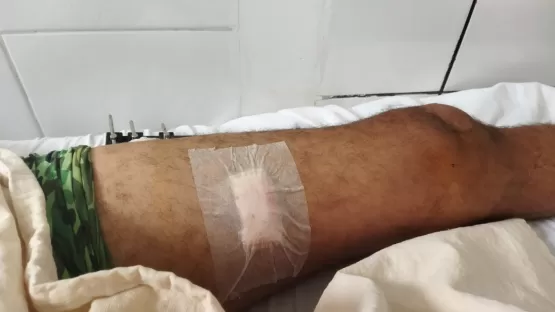 “Eu não atirei nele”, pescador dá sua versão da briga que terminou com dois baleados em nova Viçosa