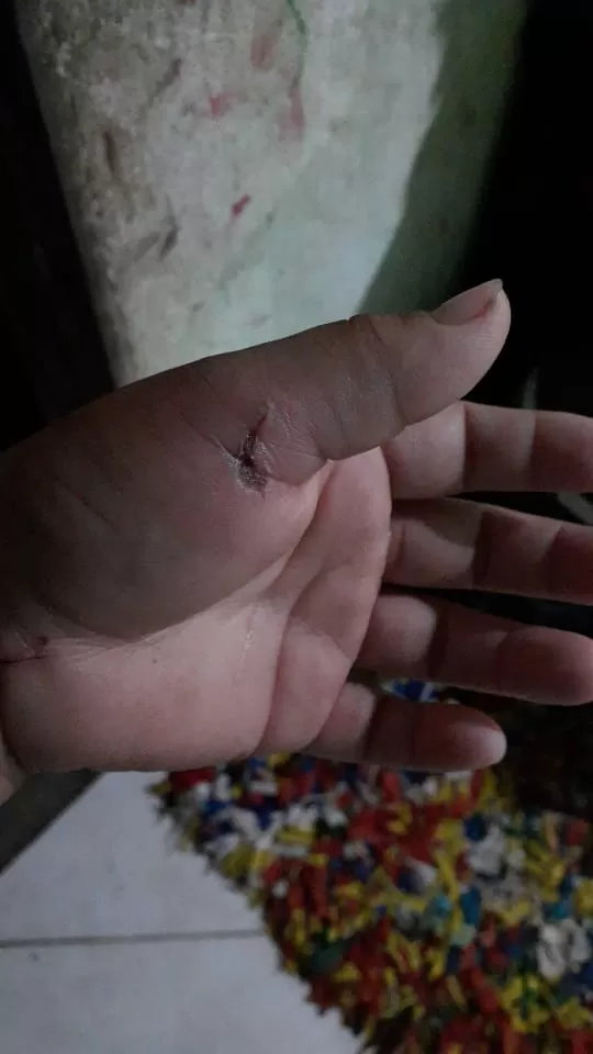 Moradora de Nova Tribuna é agredida e tem pertences queimados pelo companheiro
