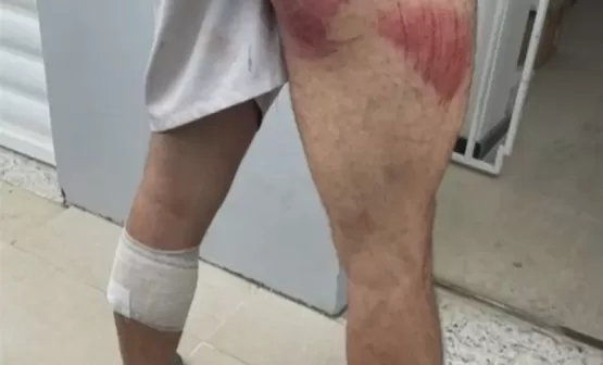 Bandidos invadem casa e fazem médico e duas empregadas reféns na cidade de Guaratinga
