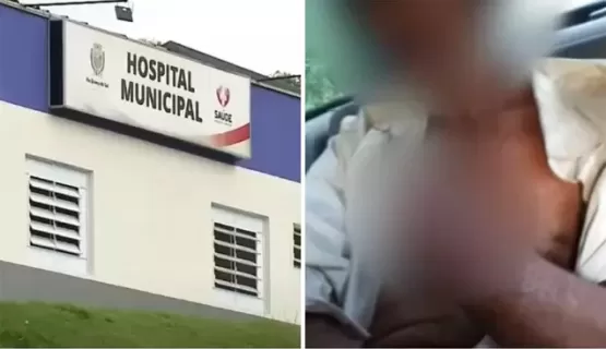 Idoso tem mão decepada por fazendeiro após cobrar dívida de R$ 300
