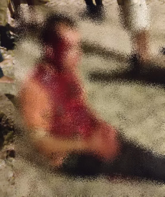 Homem é baleado 5 vezes em tentativa de homicídio em Medeiros Neto