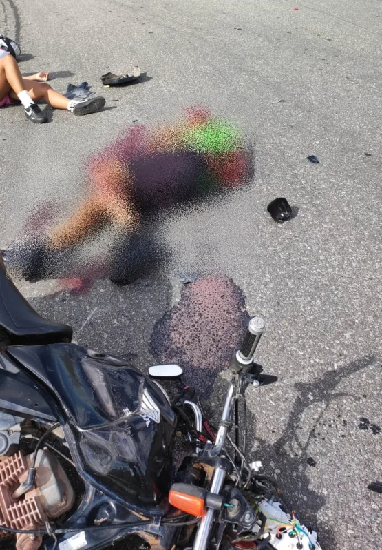 Casal fica gravemente ferido em colisão de moto com carro no Trevo de Caravelas