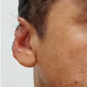 Homem finge sequestro e corta as próprias orelhas para reatar namoro