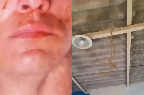 Homem tenta simular suicídio com corda e molho de tomate no rosto após ser denunciado por namorada