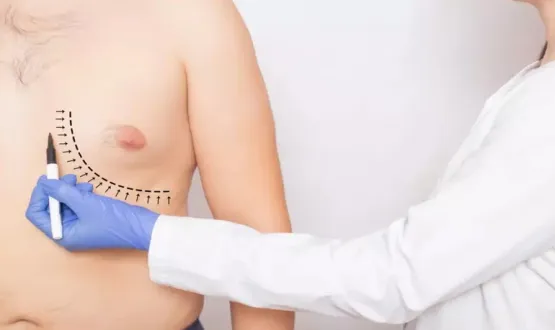 Ginecomastia: veja como famosos corrigiram condição nas mamas