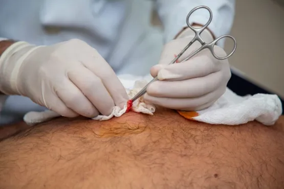 Saiba como o fluxo de cirurgias gerais no Hospital Municipal de Teixeira de Freitas beneficia a rede pública de saúde