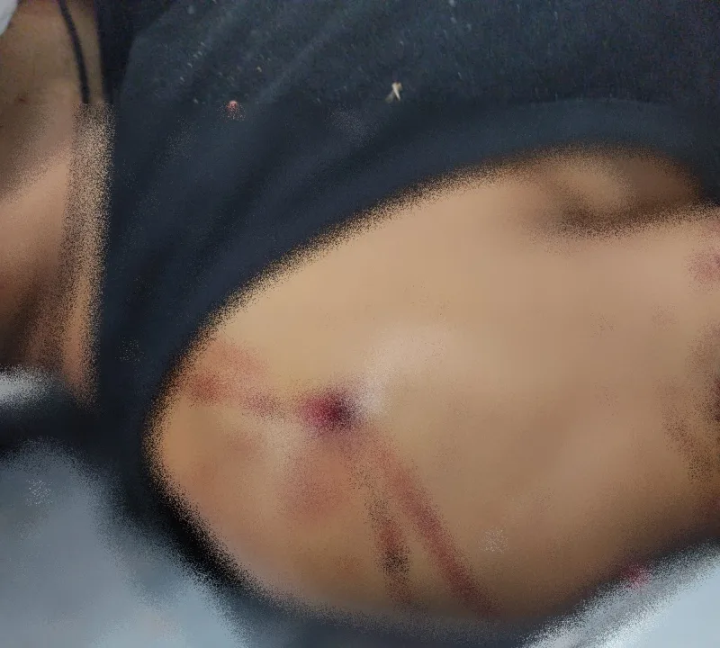 Homem é executado dentro de casa no Prado; companheira é baleada no pé