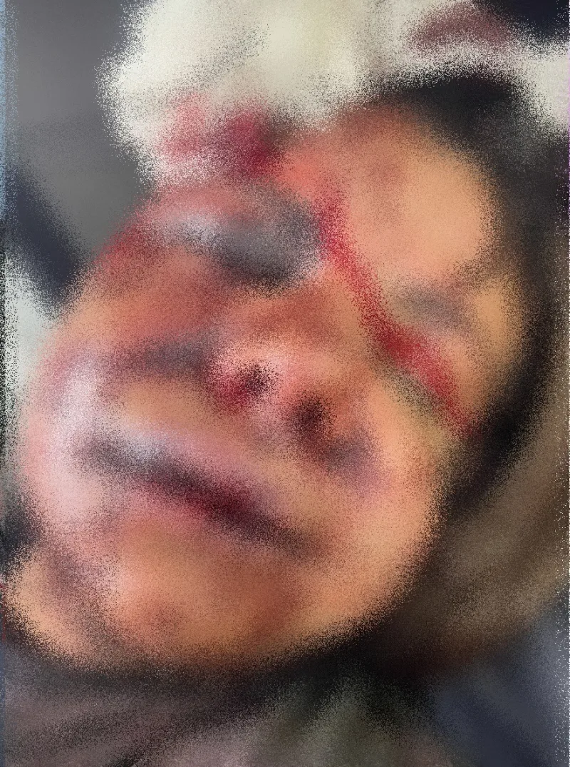 Mulher tem rosto desfigurado ao ser agredida com mais de 60 socos por namorado dentro de elevador; veja o vídeo