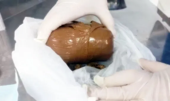Grávida é submetida a cirurgia após tentar entrar em presídio com droga, na Bahia