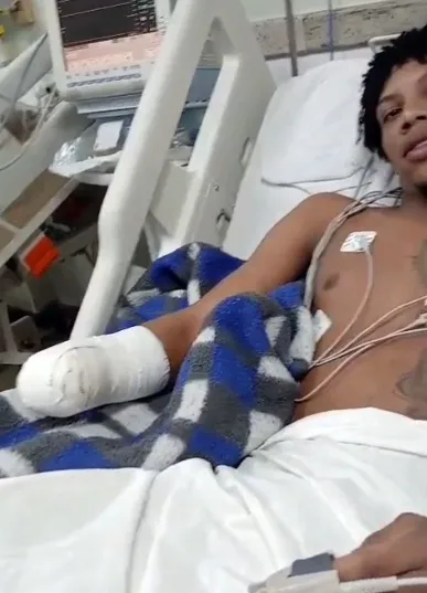 Açougueiro tem mão triturada em máquina de moer carne em supermercado no ES Açougueiro tem mão triturada em máquina de moer carne em supermercado no ES