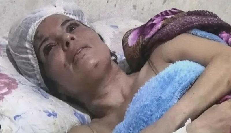 Mulher é enterrada viva pelo ex-namorado após tentativa de feminicídio em Itabuna