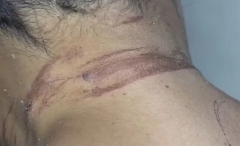 Mulher é enterrada viva pelo ex-namorado após tentativa de feminicídio em Itabuna