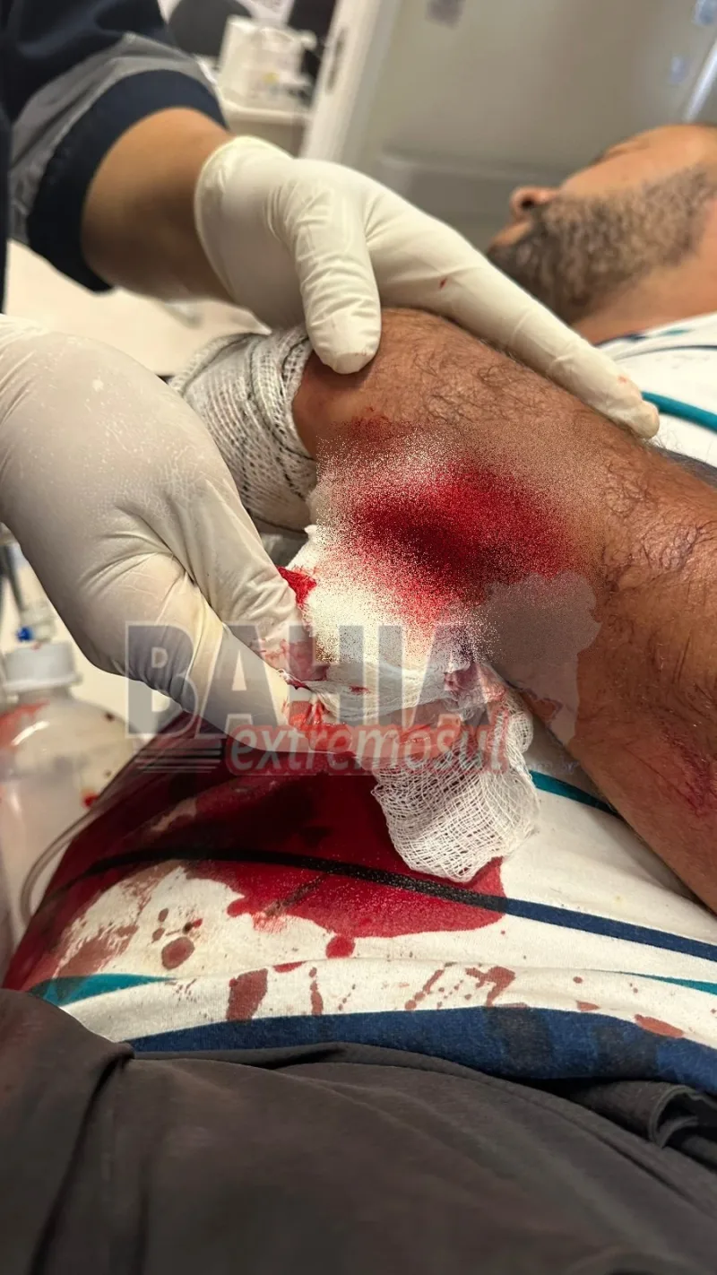 Cantor de Lajedão ataca rival com facão dentro de boate e foge após tentativa de homicídio Cantor de Lajedão ataca rival com facão dentro de boate e foge após tentativa de homicídio