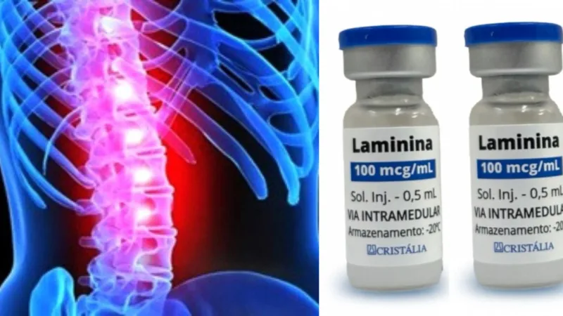 Anvisa libera estudo com medicamento para lesões na medula espinhal Anvisa libera estudo com medicamento para lesões na medula espinhal
