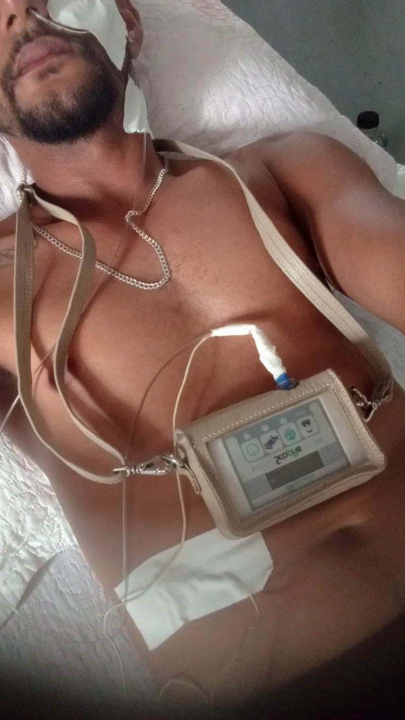 Ajude Romário - Morador de Teixeira precisa de uma cirurgia urgente por isso colocou o carro na rifa 