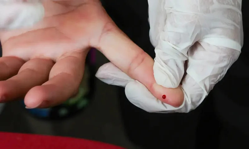 SUS passa a oferecer teste rápido de dengue SUS passa a oferecer teste rápido de dengue