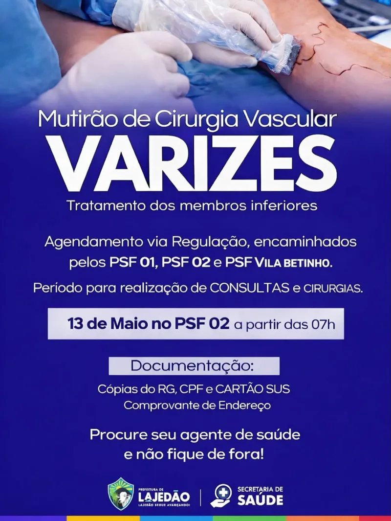 Lajedão promove mutirão de cirurgia vascular com consultas e procedimentos para tratamento de varizes Lajedão promove mutirão de cirurgia vascular com consultas e procedimentos para tratamento de varizes