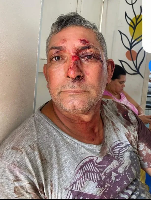 Borarcheiro que matou irmão  em Teixeira de Freitas se apresenta  à polícia