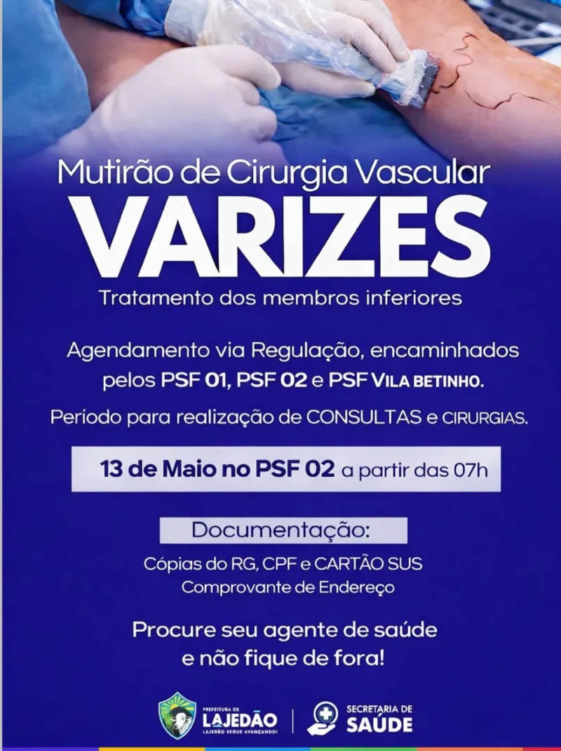 Lajedão realiza mutirão de cirurgias para tratamento de varizes