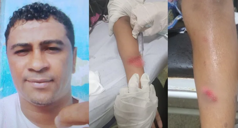 Crianças de 10 e 6 anos tentam impedir ataque contra a mãe e acabam feridas por golpes de facão na Bahia