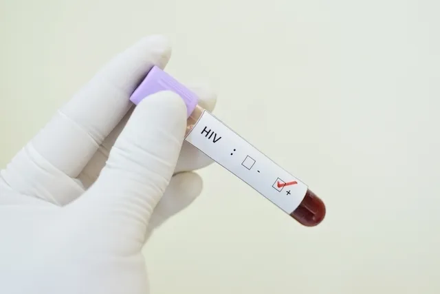Brasil apresenta estratégias de prevenção ao HIV no SUS em Conferência Internacional de Aids