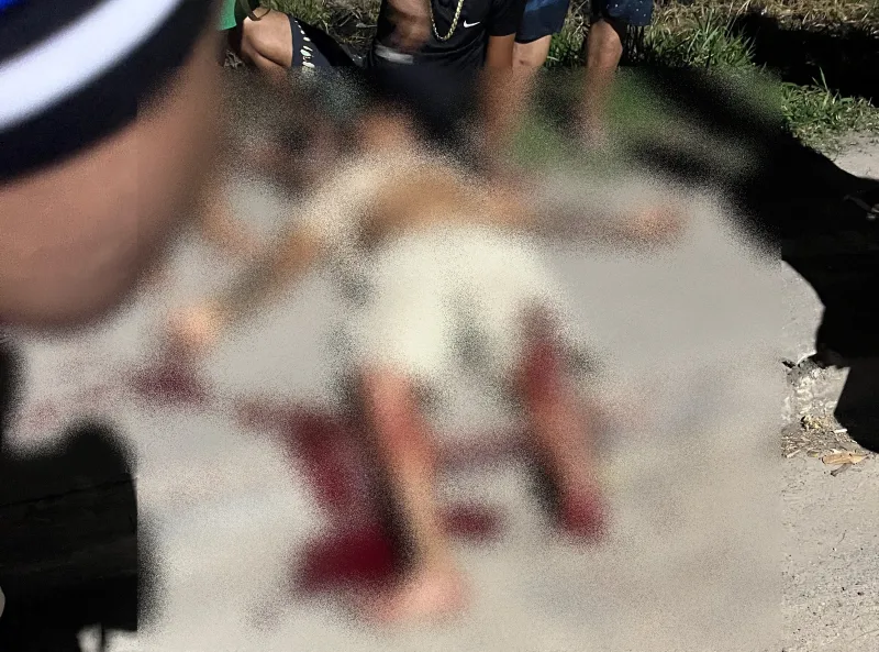 Motociclista tem pé decepado em grave acidente envolvendo dois carros em Eunápolis