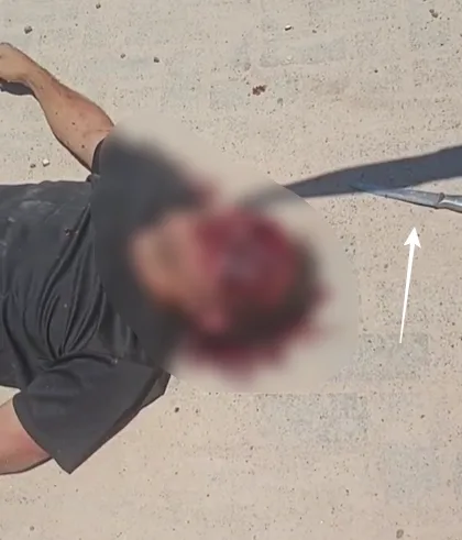Homem morre no Hospital Costa das Baleias após ser agredido com pedaço de pau. Agressor alega que foi chamado de 