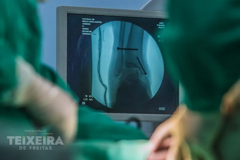Ortopedia do HMTF registra mais de 480 atendimentos em setembro