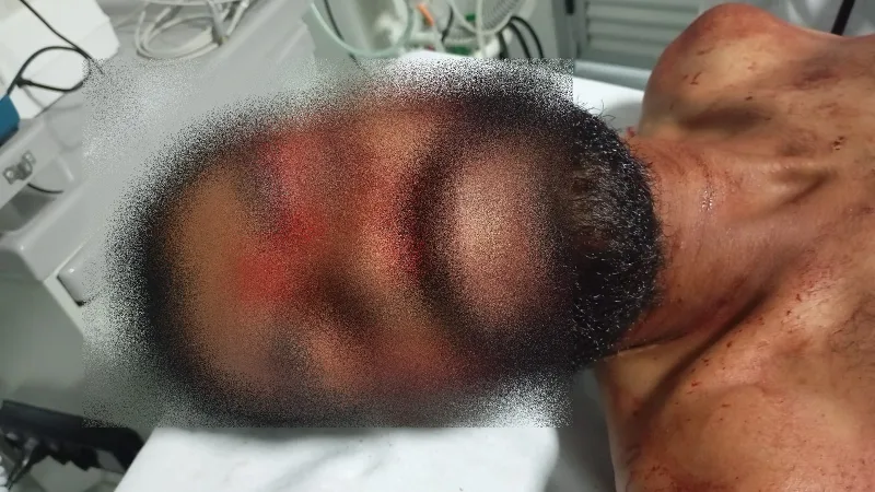 Homem é ferido a golpes de facão após tentar roubar celular de idosa em Nova Viçosa