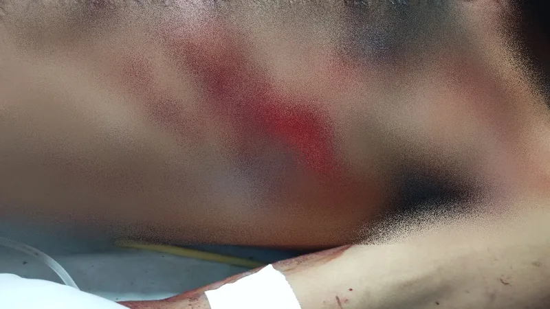 Homem é ferido a golpes de facão após tentar roubar celular de idosa em Nova Viçosa