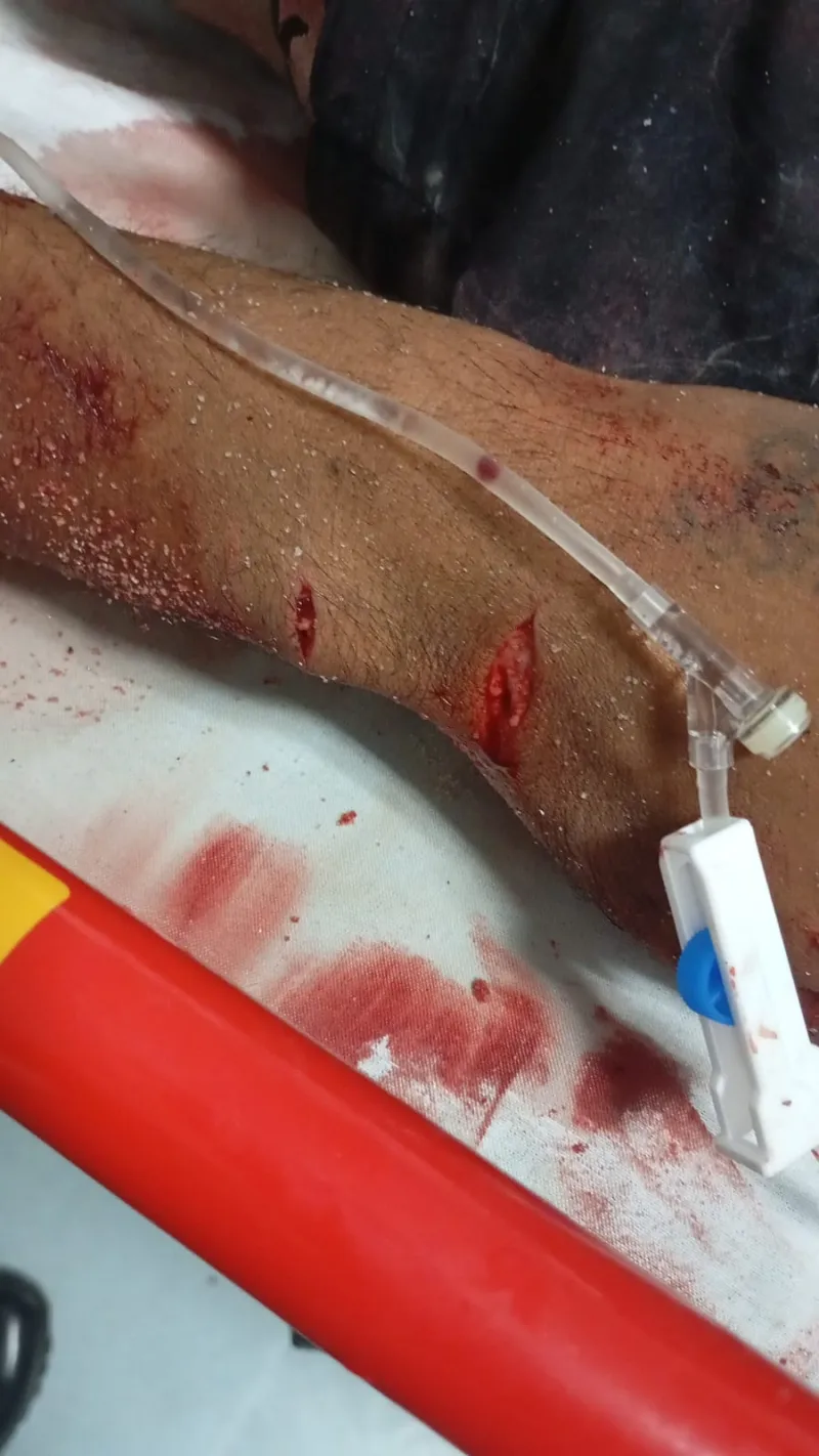Homem é ferido a golpes de facão após tentar roubar celular de idosa em Nova Viçosa