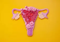 4 mitos e verdades sobre cistos ovarianos