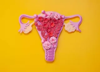 4 mitos e verdades sobre cistos ovarianos