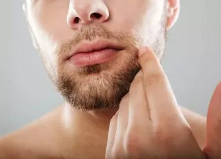 5 dicas para quem tem espinhas na região da barba