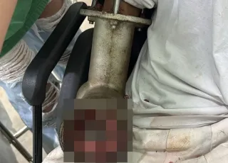 Açougueiro tem mão triturada em máquina de moer carne em supermercado no ES
