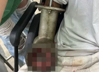 Açougueiro tem mão triturada em máquina de moer carne em supermercado no ES
