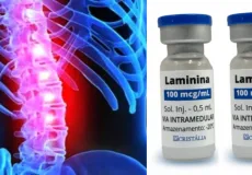 Anvisa libera estudo com medicamento para lesões na medula espinhal