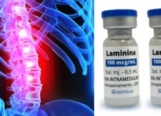 Anvisa libera estudo com medicamento para lesões na medula espinhal