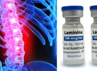 Anvisa libera estudo com medicamento para lesões na medula espinhal