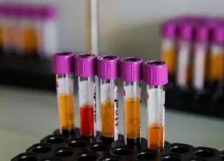 Anvisa libera farmácias para aplicarem teste rápido de covid-19