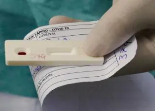 Bahia tem 1.720 casos registrados de Covid-19 nas últimas 24 horas