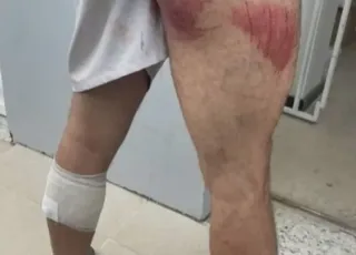 Bandidos invadem casa e fazem médico e duas empregadas reféns na cidade de Guaratinga