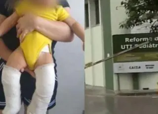 Bebê de 10 meses tem as duas pernas quebradas por padrasto