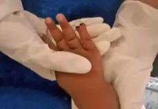 Bebê tem parte do dedo amputada após erro de enfermeira