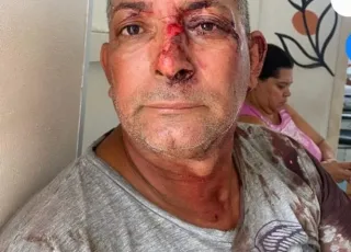 Borracheiro que matou irmão  em Teixeira de Freitas se apresenta  à polícia